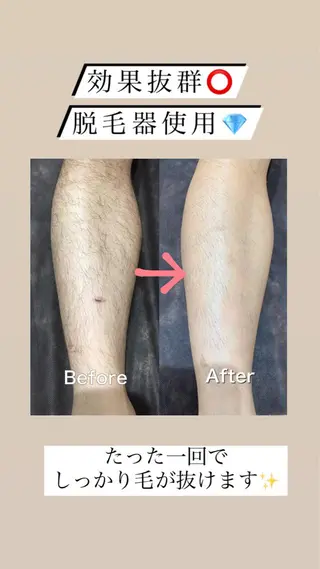 セミロング カラー パーマ ヘアアレンジ メンズ キッズ ネイル マツエク・マツパ アイブロウ Chloe-クロエ- 脱毛/フェイシャルのエステ・リラクイメージ