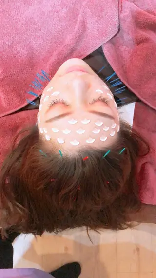 美容鍼灸女性専用 りんご鍼灸治療院のその他イメージ