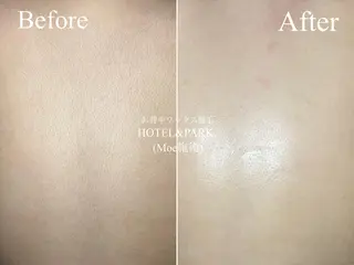 HOTEL&PARK . ワックス脱毛のエステ・リラクイメージ