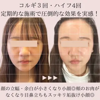 第一印象専門サロン ADISEのエステ・リラクイメージ