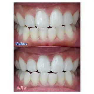 MBEAUTYSALON 千葉店・京成大久保所属・Melty 輝のその他イメージ