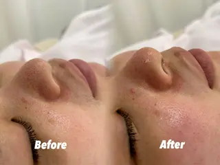 🫧美しい素肌へ🫧 今成柚乃のその他イメージ