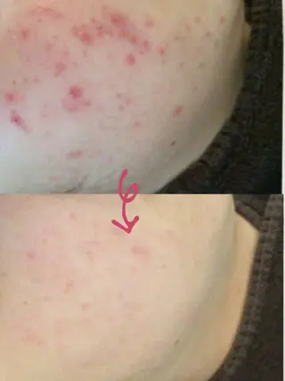 痩身リンパダイエット 隠れ家サロンチャームのエステ・リラクイメージ