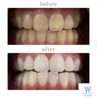 ホワイトニング ショップ本八幡店のエステ・リラクイメージ