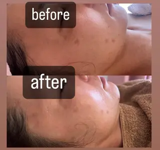 salon＿drop所属・salon dropのエステ・リラクイメージ