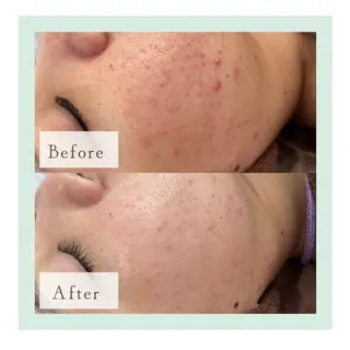 ホワイトニング専門店 御殿山/吉祥寺店のその他イメージ