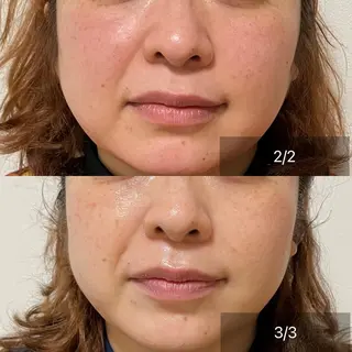 未病ケアサロン EMINY所属・未病ケアサロン EMINY☺︎勝俣のエステ・リラクイメージ