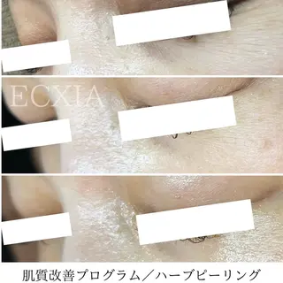 ECXIA 【エクシア】のエステ・リラクイメージ