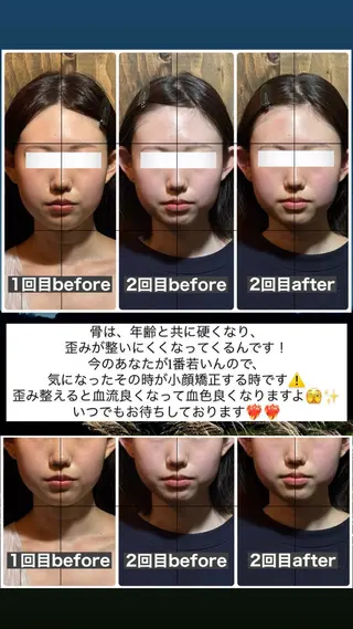 💎後悔させない小顔 矯正💎イトヤマ🌱のエステ・リラクイメージ