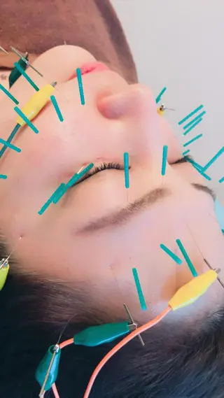 セミロング マツエク・マツパ はりすたいる 鍼灸院のエステ・リラクイメージ