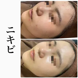 ハーブピーリング専門 BIOPLUS+川崎のエステ・リラクイメージ