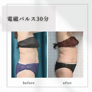 小顔矯正専門店 【RED】池田のエステ・リラクイメージ