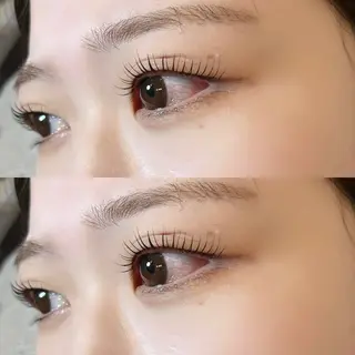 ใใใจใฏใปใใใ ๐๐๐๐๐ ๆ่ฑใฎใใใจใฏใปใใใใใถใคใณ