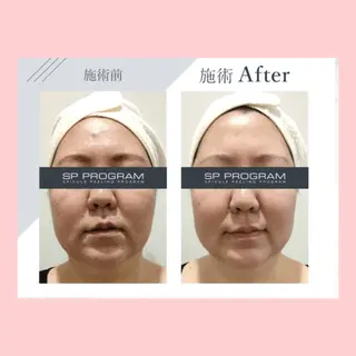 Palum Airiのエステ・リラクイメージ