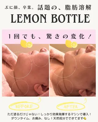 ell 東大阪所属・🎀BiBi韓国美容 コスパ強！美活サロンのエステ・リラクイメージ