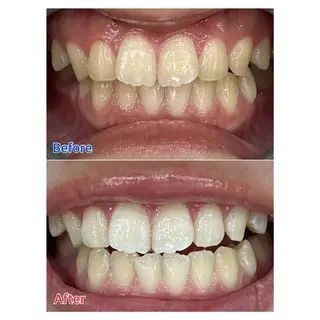 MBEAUTYSALON 千葉店・京成大久保所属・Melty 輝のその他イメージ