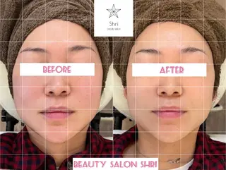 salon Lewis Addict所属・ルイスアディクト 名駅店のエステ・リラクイメージ
