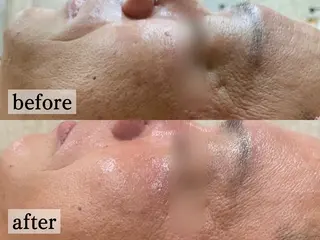 フェイシャル/脱毛 ジョアアンジェ竹田のエステ・リラクイメージ