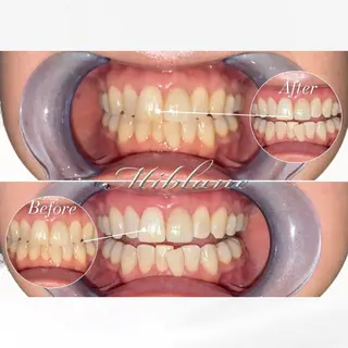 ホワイトニング MIBLANC上野店のその他イメージ