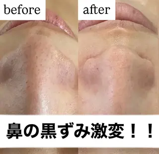 脱毛&美容サロンBLUESEA所属・脱毛&美容サロン BLUESEAのエステ・リラクイメージ