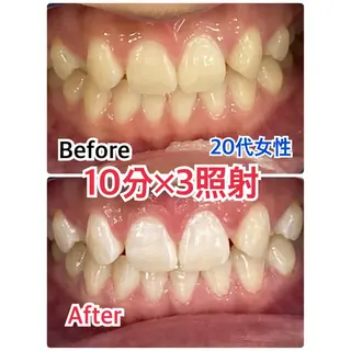 プラチナムビューティー柏所属・【歯科提携】柏ホワイ トニングスタイルのその他イメージ