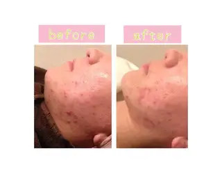 癒し腸もみサロン シャユーム　ゆきなのエステ・リラクイメージ