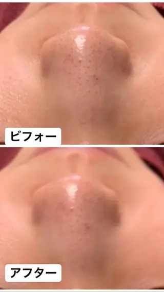 Lien オーナー 山口智嘉のエステ・リラクイメージ