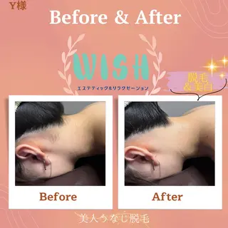 WISH 美肌脱毛のプロ！須藤のエステ・リラクイメージ