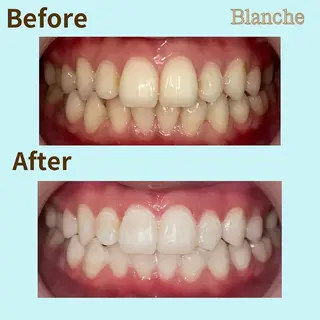 BLANCHE所属・Blanche 心斎橋のその他イメージ