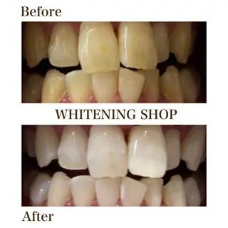 メンズ ホワイトニング ショップ川越店のエステ・リラクイメージ