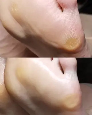 ネイル ROUN' 齋藤のエステ・リラクイメージ