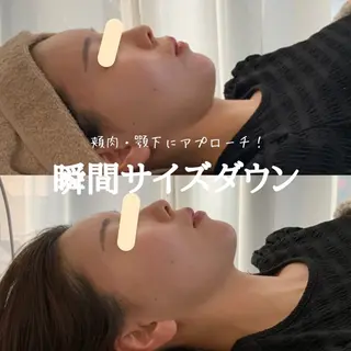 最速小顔・肌質管理 ❣️エスポワールのエステ・リラクイメージ