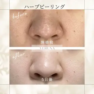 ピーリング専門店 Belluteのエステ・リラクイメージ