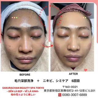 ニキビ、痩身、脱毛、 サクラチャンスパのエステ・リラクイメージ