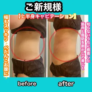 痩身/脱毛/ネイル HARUKAのエステ・リラクイメージ