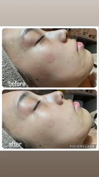 エステ✖️ネイル Feelのネイルデザイン