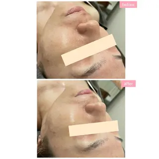 Monart -deux-のエステ・リラクイメージ