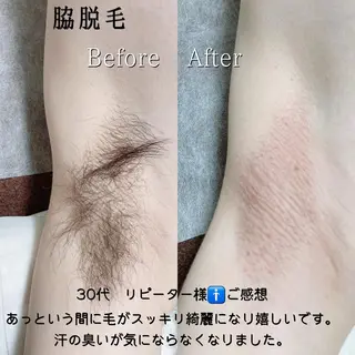 メンズ 脱毛サロン KiWiのエステ・リラクイメージ