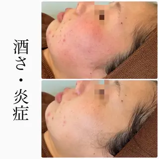 ハーブピーリング専門 BIOEL横浜のエステ・リラクイメージ