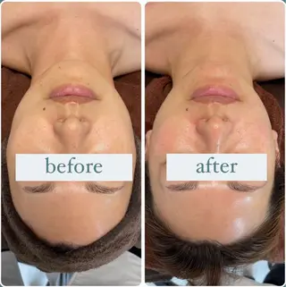 立体小顔×艶肌×美ボ ディ似合わせ施術 岡のエステ・リラクイメージ