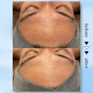 ☆痩身/小顔☆ 結果出します☆のエステ・リラクイメージ