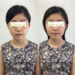 メディカルサロンドオフ所属・ハリサロンドオフ 美容鍼灸×小顔整体のエステ・リラクイメージ