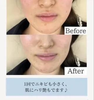 jessica🪽 yoshida🩰のマツエク・マツパデザイン