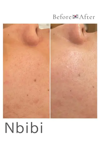 韓国🇰🇷価格 サロン_Nbibiのエステ・リラクイメージ