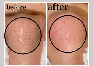 韓国肌管理 【毛穴専科】のエステ・リラクイメージ