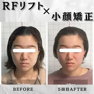 小顔矯正専門店 ❤️池田 桃花のエステ・リラクイメージ
