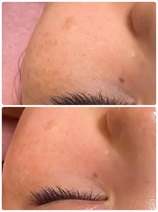 肌質改善専門店/絹々(きぬ)所属・心満たされる ハーブピーリング絹々のエステ・リラクイメージ