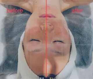 脱毛フェイシャル痩身 エリア最安👑永野舞のエステ・リラクイメージ