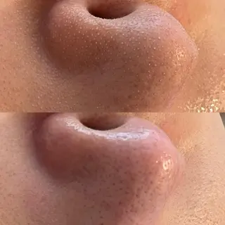 女性のお悩み美容 サロン　ヴィーナスのエステ・リラクイメージ