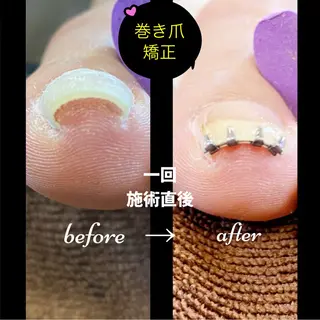 ネイル ネイル＆脱毛 Lotus🌸のネイルデザイン